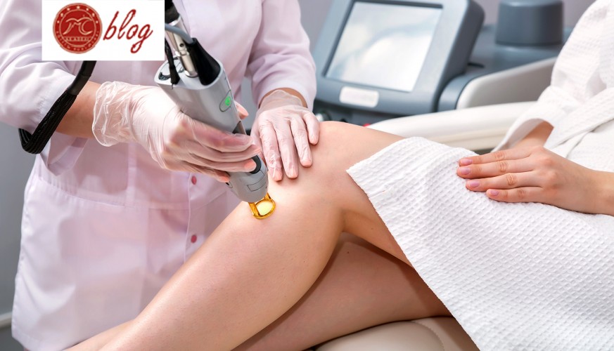 Lazer Epilasyon Hakkında Bilmeniz Gerekenler